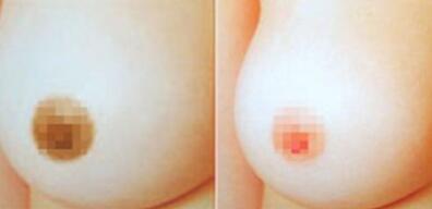 漂乳晕