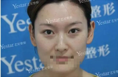 北京做皮秒激光哪里好?闺蜜素到“无妆”靓爆镜