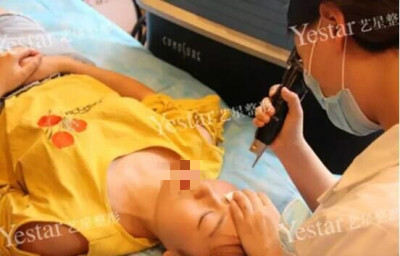 北京做皮秒激光哪里好?闺蜜素到“无妆”靓爆镜