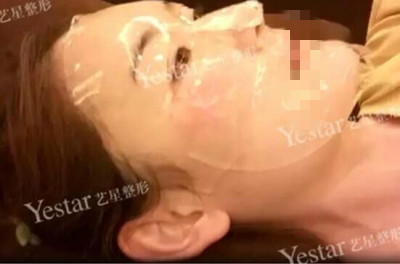 北京做皮秒激光哪里好?闺蜜素到“无妆”靓爆镜