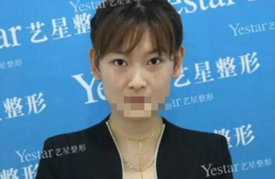 北京做皮秒激光哪里好?闺蜜素到“无妆”靓爆镜