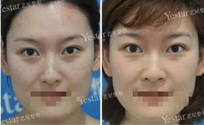 北京做皮秒激光哪里好?闺蜜素到“无妆”靓爆镜