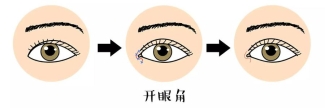 北京做开眼角手术的价格？打开你的魅力