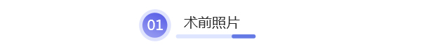 北京艺星整形医院|蜂巢皮秒指定医师李晶亲临，让求美者皮肤肤如凝脂！