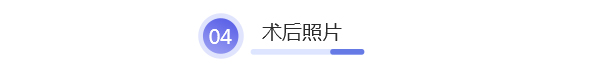 北京艺星整形医院|蜂巢皮秒指定医师李晶亲临，让求美者皮肤肤如凝脂！